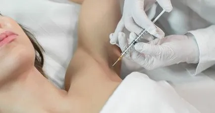 Hyperhydrosis kezelés vélemények