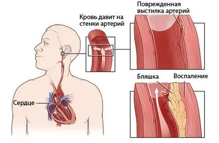 hypovolemia meg