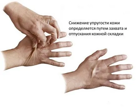 hypovolemia meg