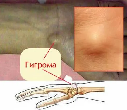 Hydroma mi ez