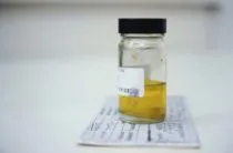 phimosis kezelése népi jogorvoslat