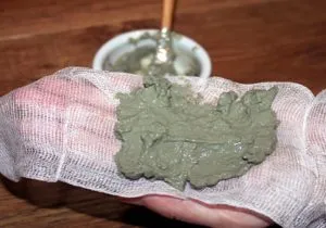 A kezelés a csont a láb a nagylábujj műtét nélkül (ujj) A kezelés a csont a láb a nagylábujj műtét nélkül