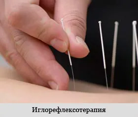Kezelés csigolyaközi sérvek műtét nélkül, hatékony módszerek