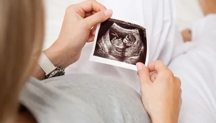 Hogy milyen időszakban lehet meghatározni a neme a babának (annak meghatározására) Hogy milyen időszakban lehet meghatározni a gyermek neme