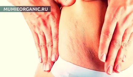 Múmiákat a csíkok a bőrön