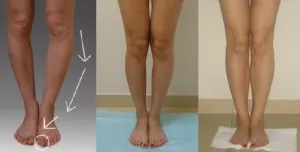 Legs kerék bebiklad