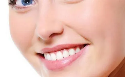 Tooth Whitening hidrogén-peroxiddal házi receptek