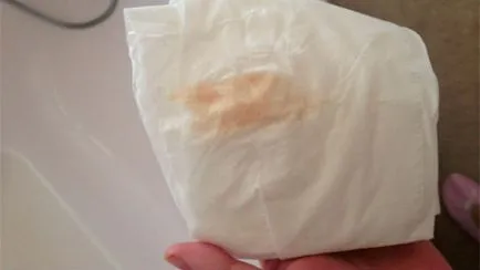 Pink mentesítés az oka a nők, az arány a patológia, hogy mikor kell orvoshoz