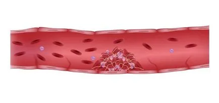 Miért húzza okozza a lábát, hogy nem, a kezelés