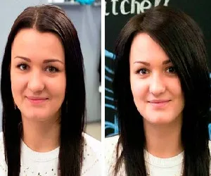 Gyökkémiában fotókeretek haj mennyisége előtt és után, a természet és az eljárás eredményeitől