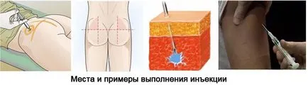 Amint beadott injekciók