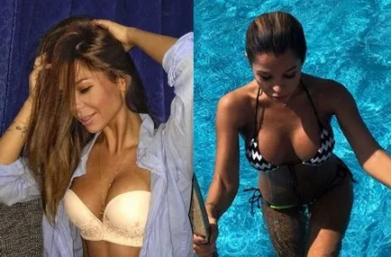 Sisters Kolisnichenko után Katia Kapelush és nyüzsgő salibekova előtt és után műanyag (fotó) - 300