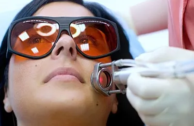 Seprűvénák a testen (rosacea) okoz, a kezelés és hogyan kell eltávolítani