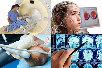 agyrázkódás a gyermek tünetei, diagnózisa, kezelése, következményei