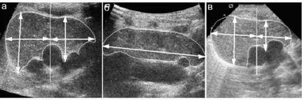 Uzi csecsemőmirigy (thymus), mi ez, miért van szükség (a csecsemőmirigy végezzük) Uzi csecsemőmirigy (thymus), mi ez, miért van szükség