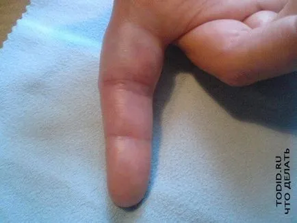 A dombornyomott ujj - mit 1000 kedvenc tippek (oktatás) A dombornyomott ujj - mit 1000 kedvenc tippek