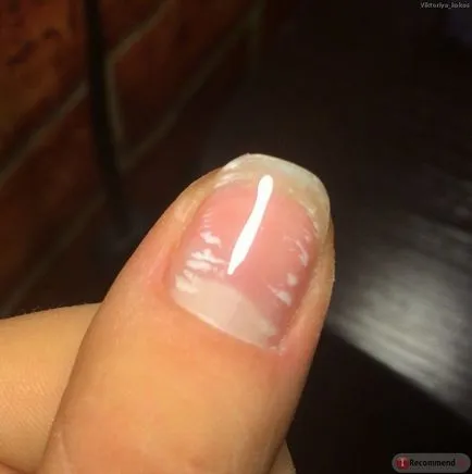 Alignment Biogel körömlemez, vagy egy alap lakk, ahogy ez megtörtént, a videó (gel) Alignment Biogel körömlemez, vagy egy alap lakk, ahogy ez megtörtént, a videó