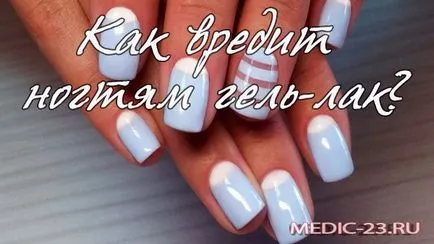 Harm gél körömlakk, hogy a termék összetétele, hogyan befolyásolja a körömlemez (kár) Harm gél körömlakk, hogy a termék összetétele, hogyan befolyásolja a körömlemez