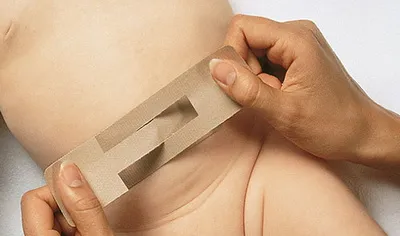 Bandage a köldöksérv csecsemők (gyermek)