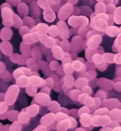 Mi is a béta-hemolitikus streptococcus