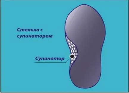 Mi a lábfej a gyermek cipő divatos gyermek ruházat (lábfej) Mi a lábfej a gyermek cipő divatos gyermek ruházat