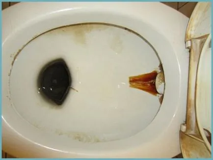 Hogyan tisztítsa meg a WC- Hogyan tisztítsa meg a WC-