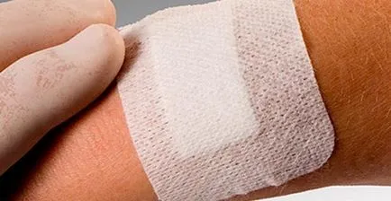 Ha letéphető az anyajegy - azaz, hogy mi a teendő kár esetén