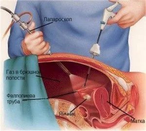 Nőgyógyászati ​​működés formái és helyreállítási