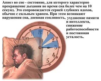 Hypersomnia okok, jelek, tünetek, és a kezelés (hiperszomnia) Aluszékonyság okai, jelek, tünetek és kezelés