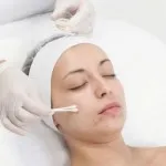 Glycolic arc héjat - értékelés (glikolsav peel eljárás) Glikolsav arc hámlani kezd - vélemények