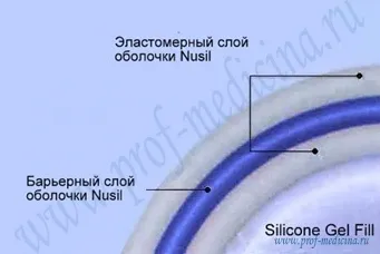 Mellimplantátumok eurosilicone - könyvtár méretben értékelés (alacsony profilú nagy) Mellimplantátumok eurosilicone - könyvtár méretben, vélemények