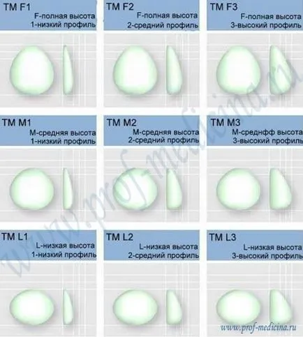 Mellimplantátumok eurosilicone - könyvtár méretben értékelés (mell formája) Mellimplantátumok eurosilicone - könyvtár méretben, vélemények