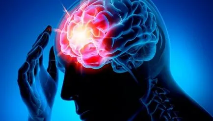 agyi infarktus tünetek, mi a különbség a stroke (agyi) agyi infarktus tünetek, mi a különbség a stroke
