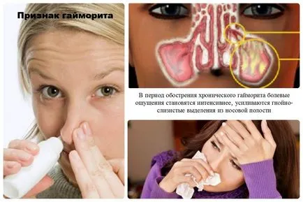Antibiotikum kezelésére arcüreggyulladás Antibiotikum kezelésére arcüreggyulladás