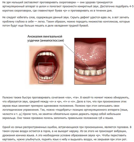 Hogyan lehet megtanulni kiejteni a levél r felnőttek otthon