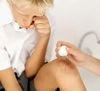 Hogyan kezeljük a sebek, horzsolások, karcolások és kisebb darabok (+ Medicine and Health) Hogyan kezeljük a sebek, horzsolások, karcolások és kisebb vágások