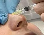 Hogyan lehet az orr kevésbé otthon, hialuronsav (belföldi) Hogyan lehet az orrod kisebb otthoni, hialuronsav