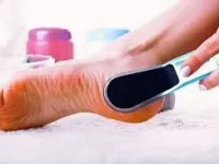 Hogyan lehet megbirkózni a durva bőr sarkú sarok mindig sima és gyönyörű! (Jobb) Hogyan lehet megbirkózni a durva bőr sarkú sarok mindig sima és gyönyörű!