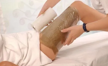 Hogyan lehet eltávolítani a cellulit lyashek otthon fotók, videók