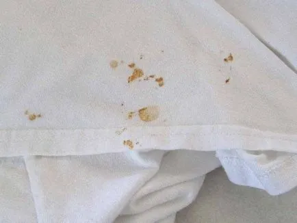 Hogyan lehet eltávolítani a foltot egy fehér ruhát, a leghatékonyabb eszköz a videó