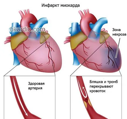 A kardiológus, aki azt, hogy meggyógyítja, amikor a kapcsolatot vele (kúrák) A kardiológus, aki azt, hogy meggyógyítja, ha beszélnek hozzá