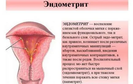 Barna mentesítés a menstruáció után egy héttel - mi ez
