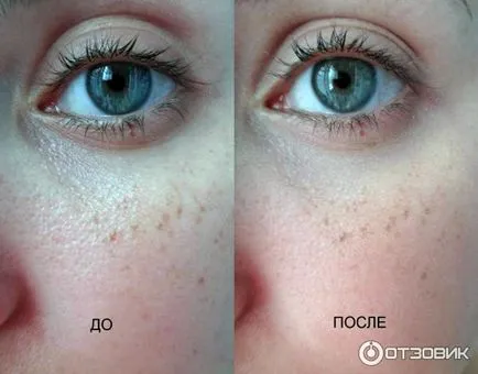 Korrektor l - oreal szövetség tökéletesen valósághű mérkőzés felülvizsgálat