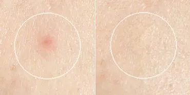 Kryolan dermacolor álcázás krém vélemények