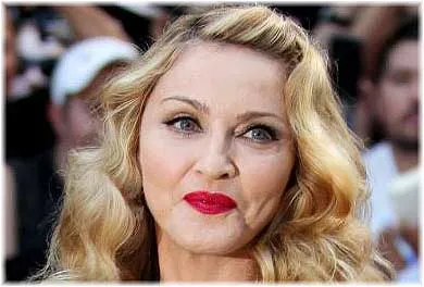 Madonna plasztikai sebészet fotók előtt és után