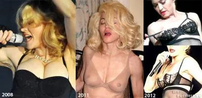 Madonna Plasztikai Sebészet - Plasztikai - Kiadó - műanyag test