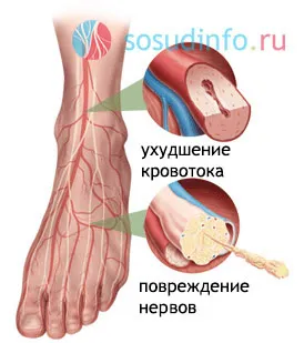 Mikrokeringési rendellenességek, javult (gyógyszerek) (javulás) Mikrokeringési rendellenességek, javult (gyógyszerek)