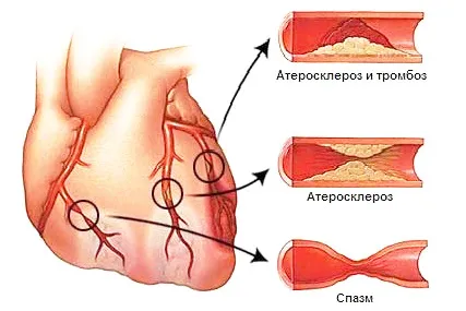 Mikrokeringési rendellenességek, javulását (termékek) (termékek) Mikrokeringési rendellenességek, javult (gyógyszerek)