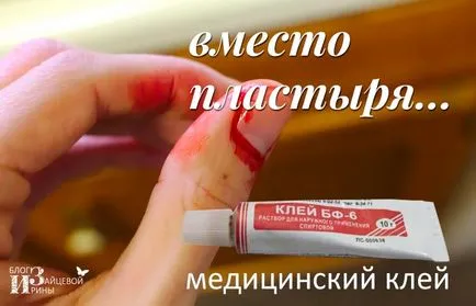 Orvosi ragasztó, blog Iriny Zaytsevoy