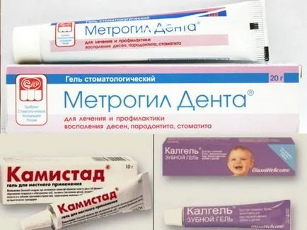 Stomatitis kenőcs gyermekeknek válogatás a legjobb alapok (stomatitis kenőcs acyclovir a gyermekek számára furatsilin Zelenka viferon dózisú tabletták) Stomatitis kenőcs gyermekek válogatás a legjobb alapokat